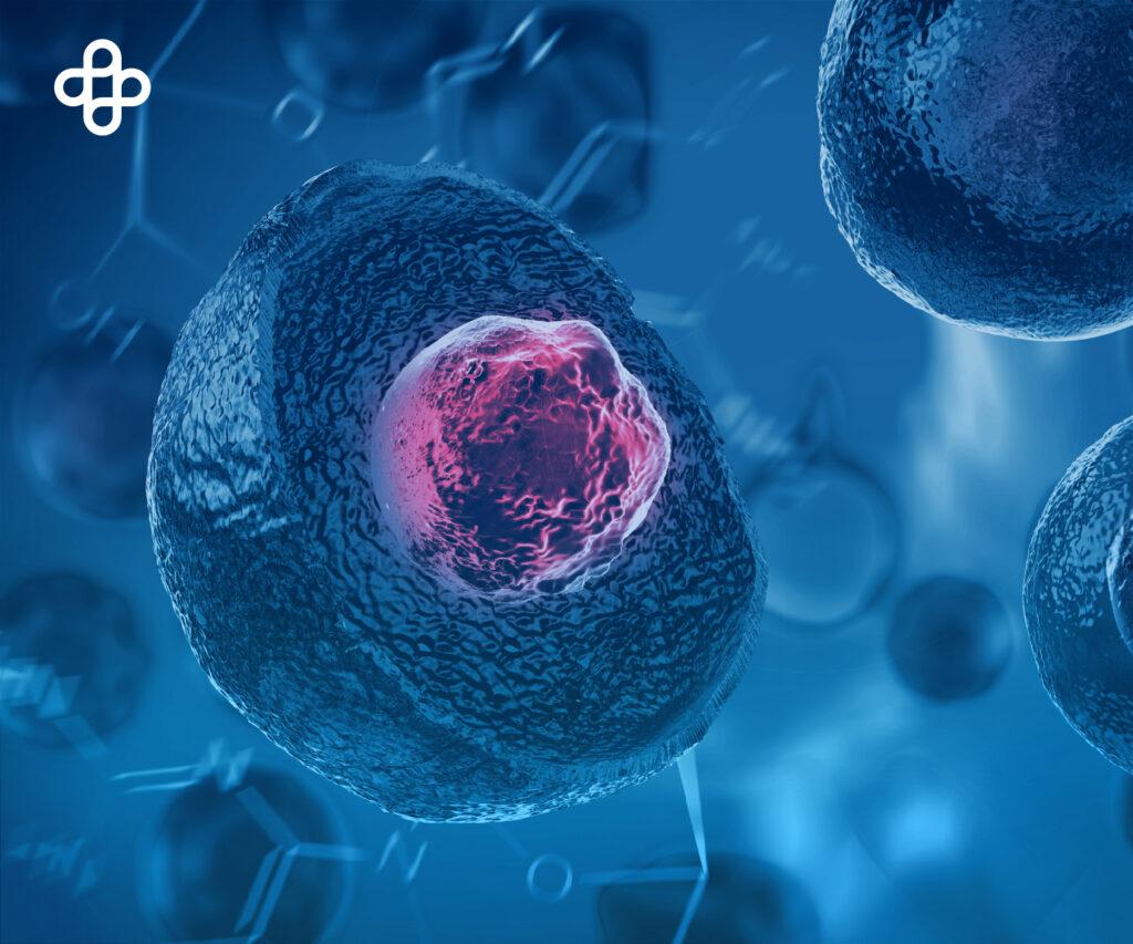 Despertando Esperanzas: Avance en el Tratamiento del Lupus con Células Madre Mesenquimales