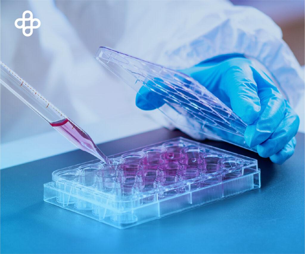 Células madre mesenquimales derivadas de la gelatina de Wharton