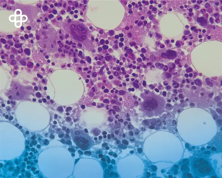 Células madre hematopoyéticas