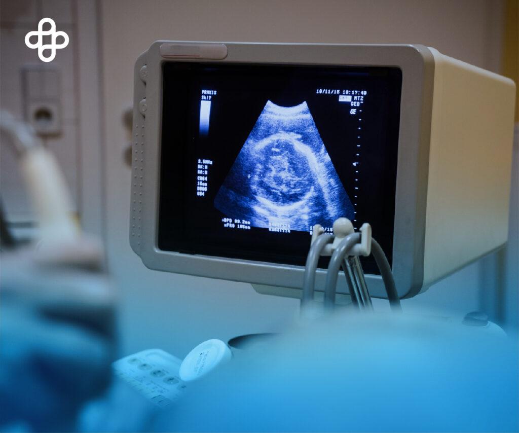 Células madre fetales