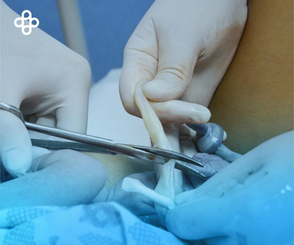 Descubre el Poder Curativo: Células Madre Humanas en la Medicina Regenerativa Moderna | ¡Inicia tu Viaje hacia la Salud