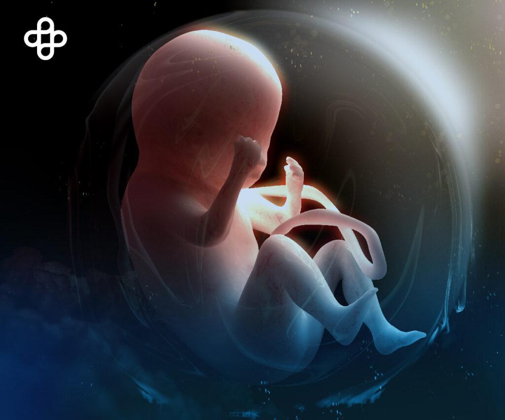 Células Madre del Líquido Amniótico: Una Nueva Esperanza en el Tratamiento de la Enterocolitis Necrotizante (NEC)